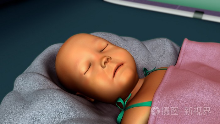 刚出生的婴儿黄疸照片-正版商用图片1o7mbe-摄图新视界