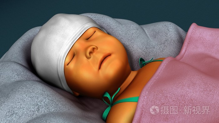 刚出生的婴儿黄疸