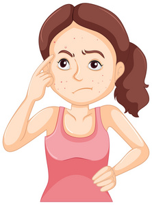 满脸的青春痘的女人照片