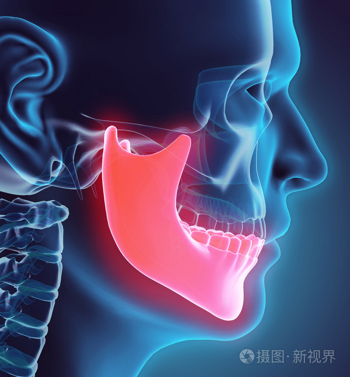 下颌骨,医疗概念三维图