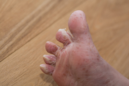 尖嘴将脚鸟图片