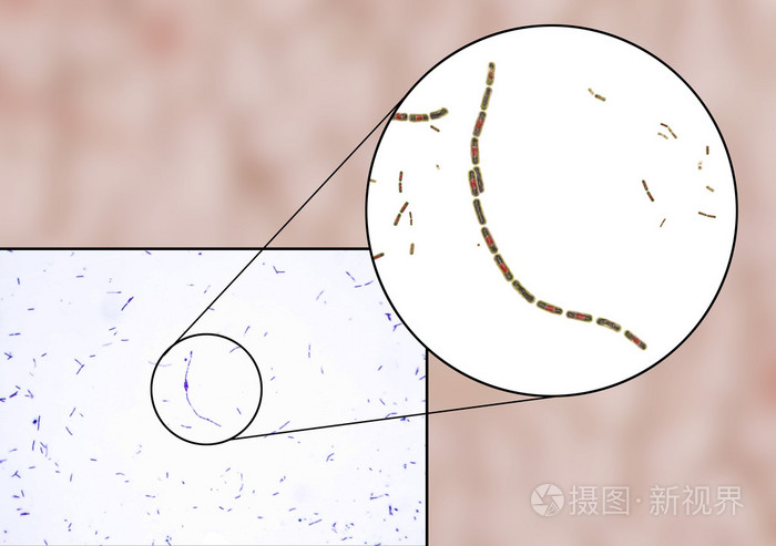 细菌芽孢杆菌炭疽