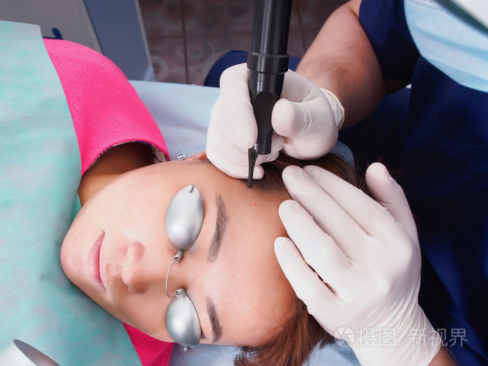 亚洲女病人有关美容医学激光过程皮肤重铺路面