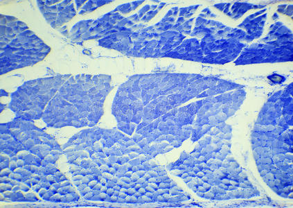 组织学 组织 增生 桅杆 肌肉 基质 挑逗 肿瘤 准备 细胞质