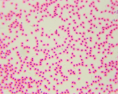 有核红细胞显微镜下的鸡红细胞血涂片鸡照片