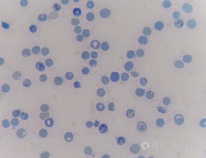 网织红细胞