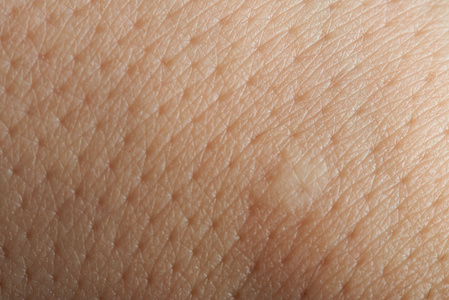 皮肤毛孔粗大图片