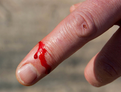 手指出血割伤图片