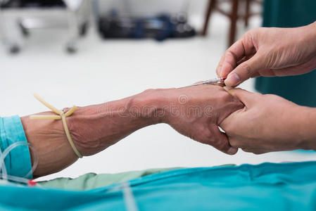 婴儿输液开放性静脉输液照片