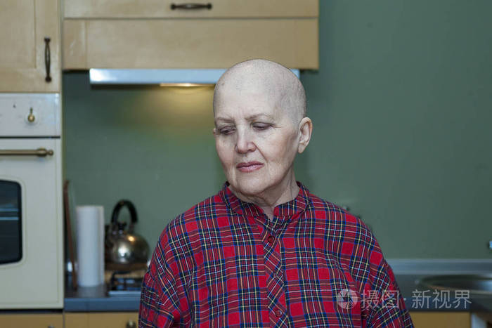 老人微笑的光头回家后化疗