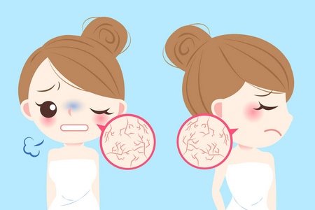 皮肤干燥卡通图片