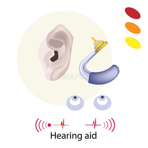 工具 听力学 附件 装置 耳朵 治愈 耳聋 耳模 沟通 帮助