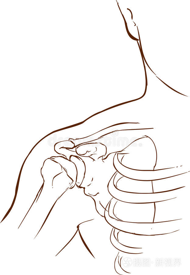 锁骨 韧带 肩胛骨 条件 人类 插图 刀片 受伤的 损伤