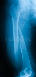 检查 人类 意外 扫描 极端 房间 形象 髌骨 临床 肌肉