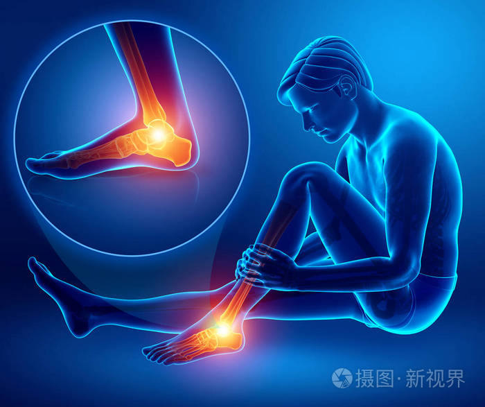 3d插图男性脚和踝关节疼痛
