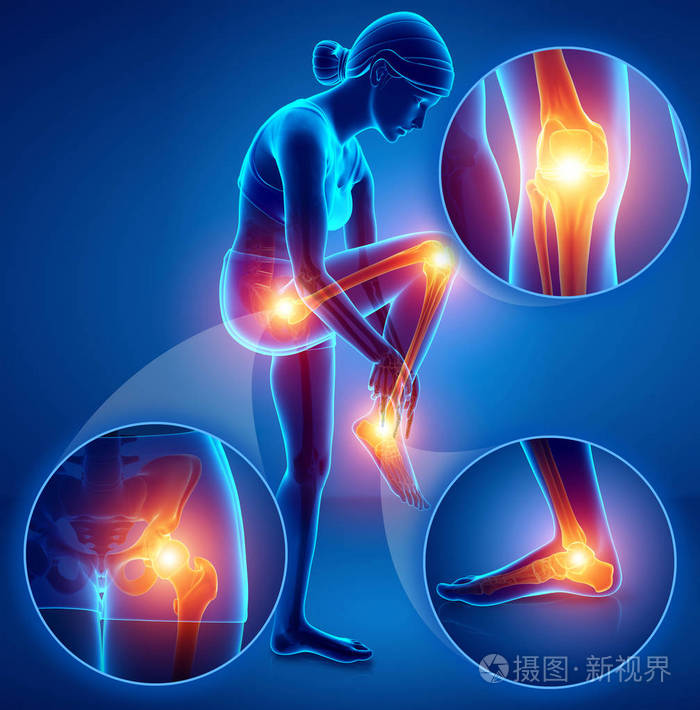 3d插图的女性感觉腿部疼痛