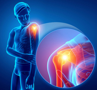 肩膀痛概念图图片