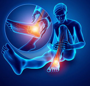 男脚和踝关节疼痛图片