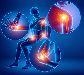 数字疼痛3d 插图女性感觉的手臂关节疼痛照片