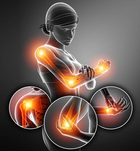 3d 插图女性感觉的手臂关节疼痛照片