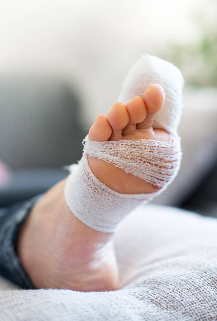 受伤的腿,在家里的沙发上的女人