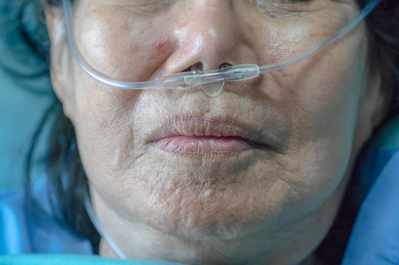 呼吸鼻老年妇女鼻呼吸管帮助她的 breathi照片