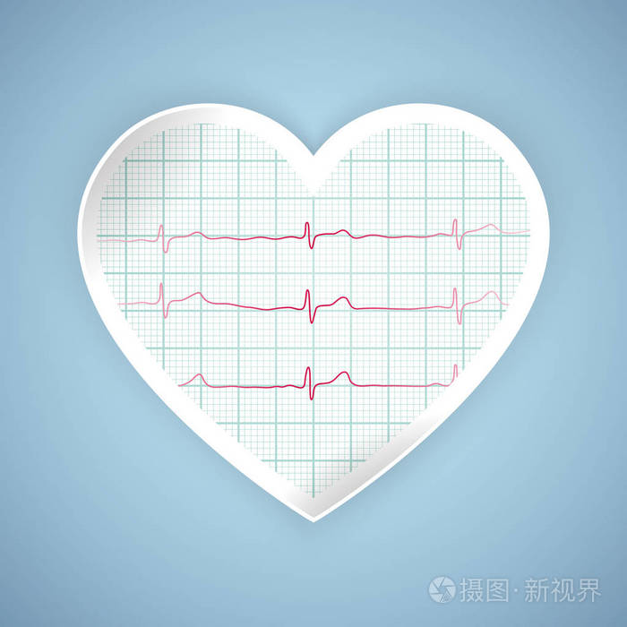 心脏脉搏图。监视器上有心电图心跳医疗保健, 矢量插画