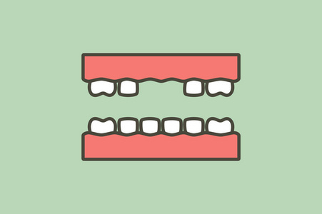 齿间缺牙间隙牙形卡通矢量平面造型可爱人物设计照片