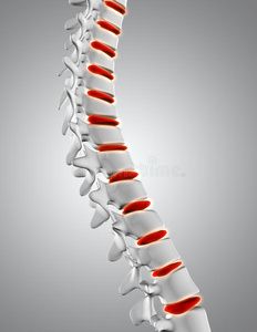 三维关闭脊柱与椎间盘突出