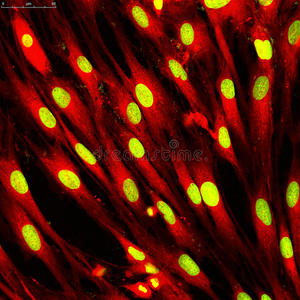 用荧光染料标记成纤维细胞皮肤细胞