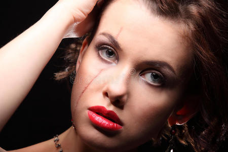 漂亮的女孩,脸上和肩膀上都有伤疤照片