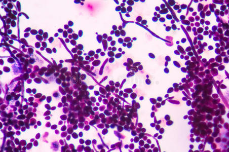 假菌丝出芽酵母细胞