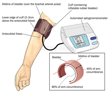 血压测量