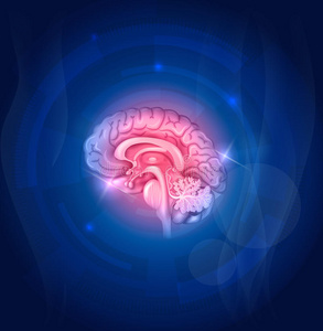 治愈 攻击 脑血管 死亡 心电图 帮助 解剖学 疼痛 公司