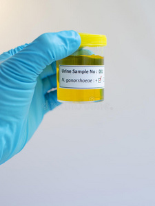 实验 淋球菌 微生物学 生物学 发烧 医学 淋病 细菌 实验室