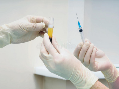 在实验室的试管中,手拿着分离的血液和注射器照片