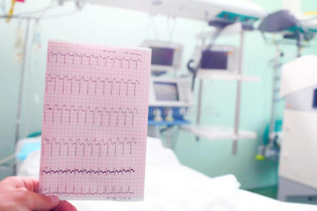 医生手中的心电图是以医疗病房为背景的