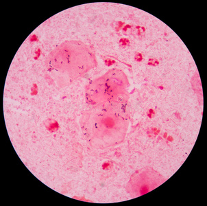 照顾 细胞 生物学 感染 白细胞 免疫学 健康 细胞质 淋巴细胞