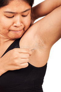 女生长胡子去除腋毛照片