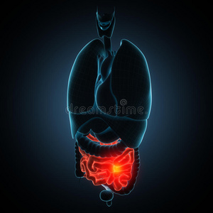 肠易激综合征 疾病 健康 消化 结直肠 生物学 中导 腹部