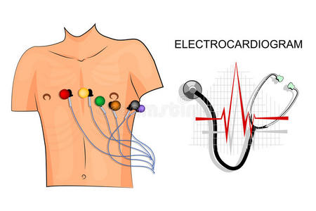 心电图电极位置图片图片
