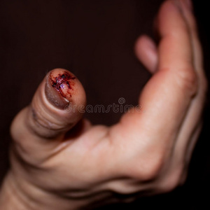 从受伤的手指上特写,伤口很脏照片