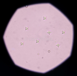 草酸钙尿分析中草酸钙晶体.照片