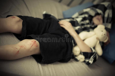 擦伤的膝盖图片