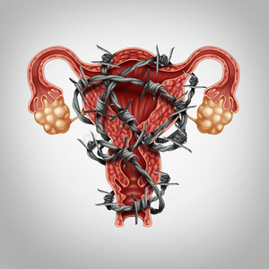 腹部 不孕 妇科学 子宫颈 输卵管 子宫内膜异位症 避孕