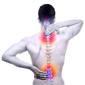 背痛 疼痛 生物学 诊断 脖子 医疗保健 健康 骨干 损伤