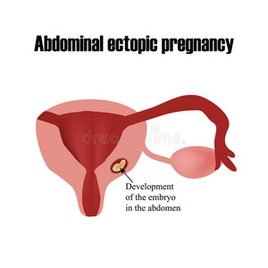 腹部胚胎的发育。