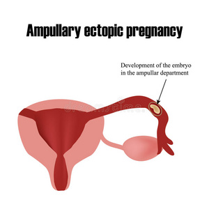 壶腹部胚胎的发育。