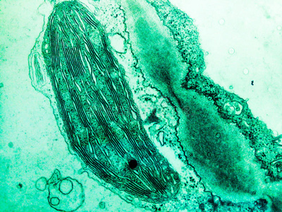叶绿体电镜照片图片