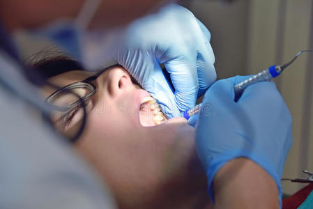 牙医进行手术